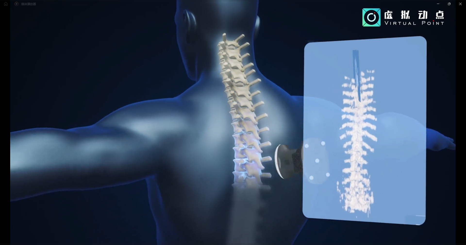 优发国际·虚拟动点OptiTrack开创3D超声成像在脊柱诊断中的应用